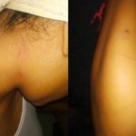 Montse y Michel fueron atacadas por sus vecinos por ser lesbianas