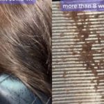 Increíble; mujer le pasa peine a su hija y lo saca repleto de piojos